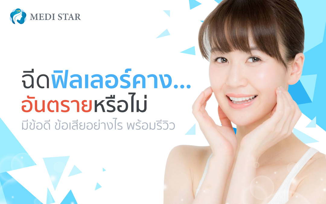 ฟิลเลอร์คาง