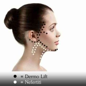 dermo-lift-nefertiti
