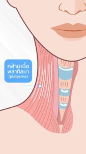 ลิฟกรอบหน้า-platyama