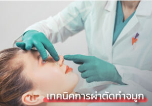 เทคนิคการผ่าตัดทำจมูก