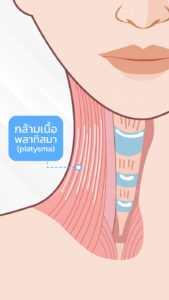 เทคนิค Nefertiti lift จะฉีดโบท็อกไปที่กล้ามเนื้อ Platysma