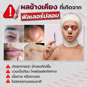 ผลข้างเคียงจากฟิลเลอร์ปลอม